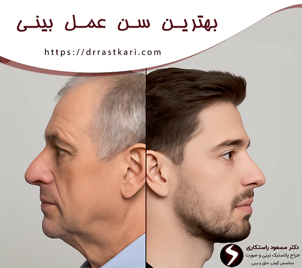 بهترین سن عمل بینی