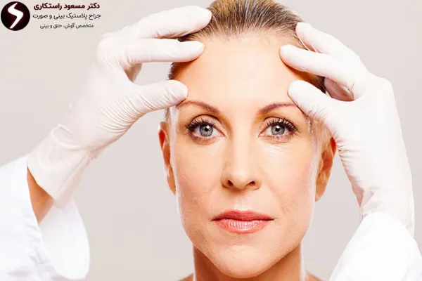 عمل لیفت شقیقه