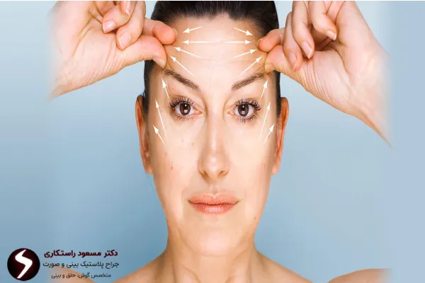 میزان هزینه جراحی لیفت شقیقه