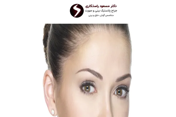 نقاهت جراحی لیفت شقیقه