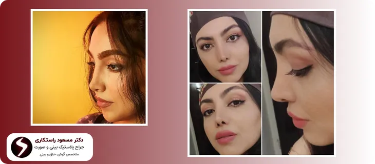 نمونه کارهای بهترین جراح بینی