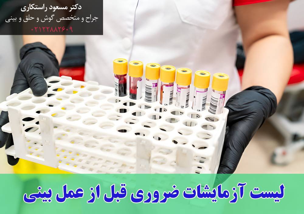 لیست آزمایشات ضروری قبل از عمل بینی لیست آزمایشات ضروری قبل از عمل بینی