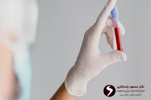 شرایط آزمایش قبل از عمل بینی شرایط آزمایش قبل از عمل بینی