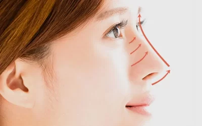 عمل بینی غضروفی | راهنمای جراحی بینی غضروفی