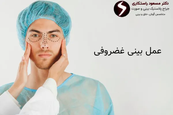 عمل بینی غضروفی چیست؟