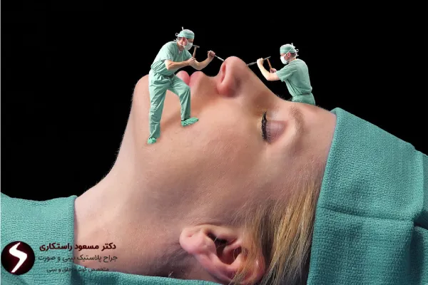 نحوه عمل بینی غضروفی