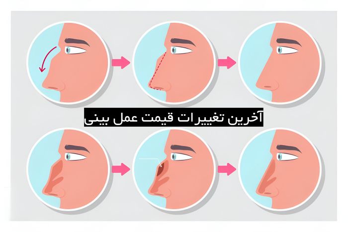 آخرین تغییرات قیمت عمل بینی آخرین تغییرات قیمت عمل بینی