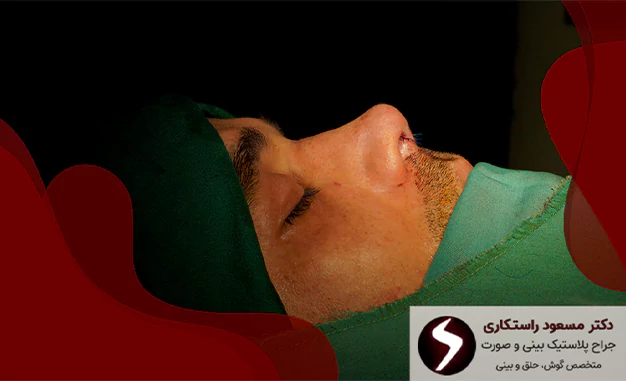 حفظ عملکرد تنفسی در جراحی بینی نیمه فانتزی حفظ عملکرد تنفسی در جراحی بینی نیمه فانتزی