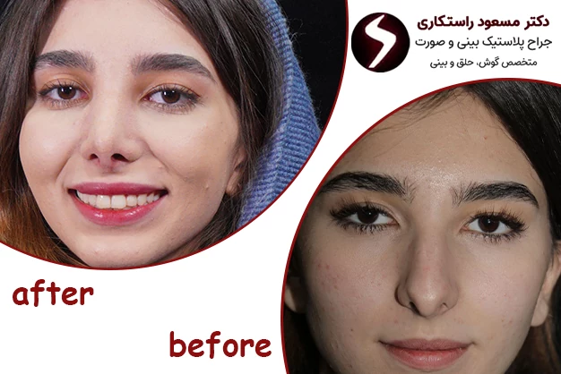 دکتر مسعود راستکاری بهترین جراح بینی بینی فانتزی در تهران