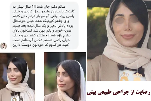 رضایت از جراحی طبیعی بینی