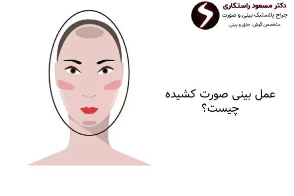 عمل بینی صورت کشیده چیست؟