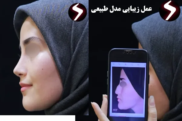 عمل زیبایی مدل طبیعی