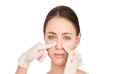 فرورفتگی پره های بینی بعد از عمل و نکات آن