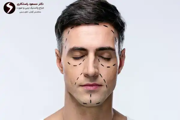 مراجعه به بهترین جراح بینی مردانه مراجعه به بهترین جراح بینی مردانه