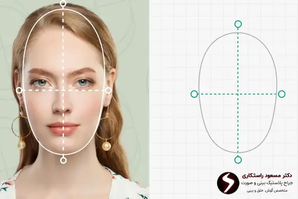 نتایج عمل بینی صورت کشیده