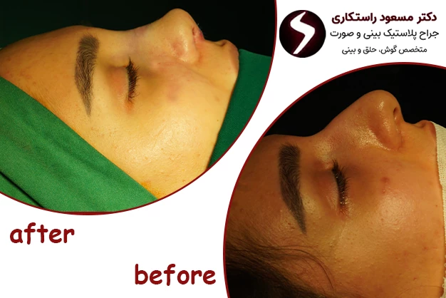 نحوه انتخاب بهترین جراح بینی فانتزی در تهران