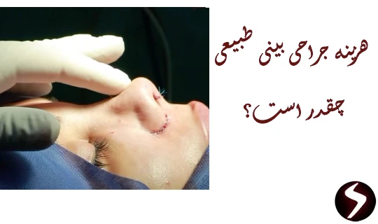 هزینه جراحی بینی طبیعی هزینه جراحی بینی طبیعی