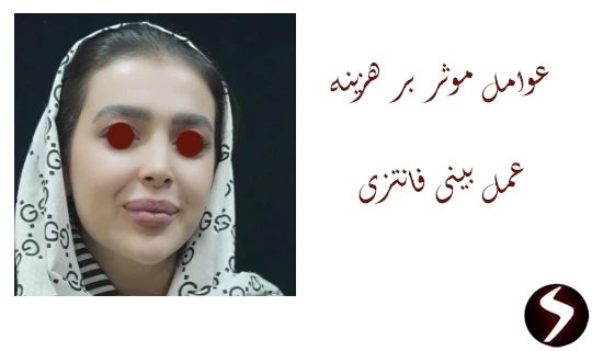 عوامل موثر بر هزینه عمل بینی فانتزی چه عواملی بر هزینه بینی فانتزی تاثیر میذارن؟