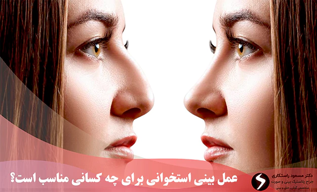 کاندیدای مناسب عمل بینی استخوانی کاندیدای مناسب عمل بینی استخوانی