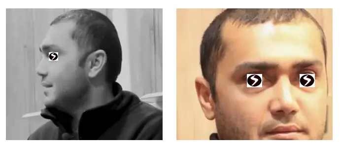 عکس قبل و بعد از جراحی بینی