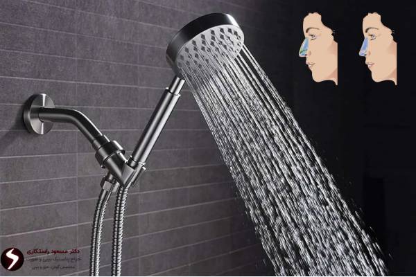 استحمام بعد از جراحی بینی استحمام بعد از جراحی بینی