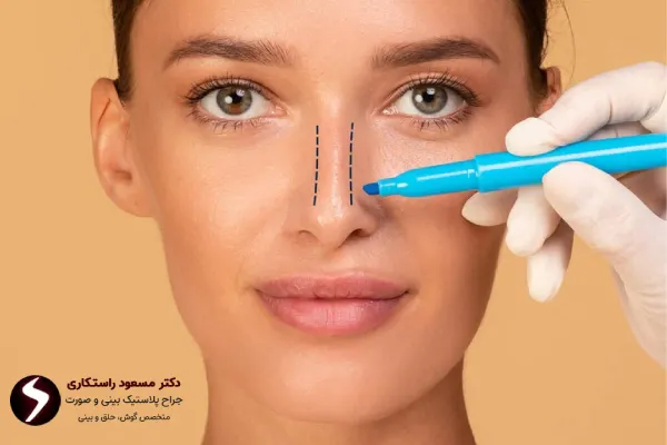 جراحی بینی به روش بسته