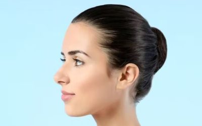 جراحی بینی پهن؛ عکس قبل و بعد، تکنیک‌ها و هزینه عمل