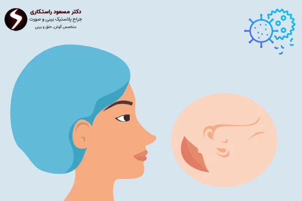 درمان عفونت بینی بعد از عمل درمان عفونت بینی بعد از عمل