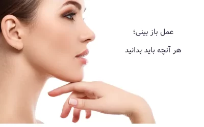 عمل باز بینی؛ هر آنچه باید بدانید!