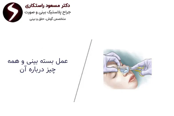 عمل بسته بینی چیست؟