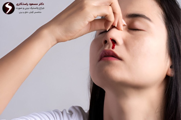 خونریزی بعد از جراحی بینی