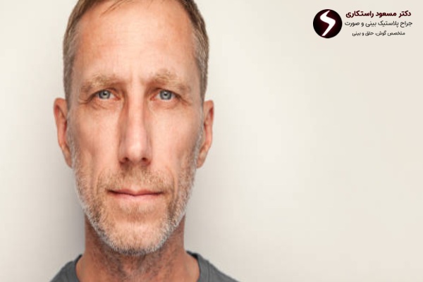 عمل بینی در افراد مسن