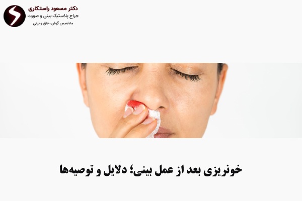 نکات خونریزی بعد از عمل بینی