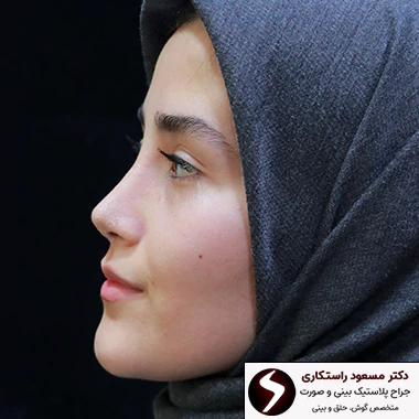 عمل زیبایی بینی