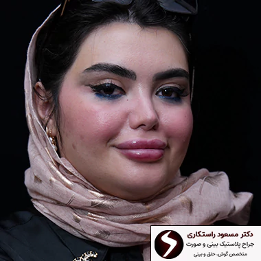 مدل عمل بینی عروسکی