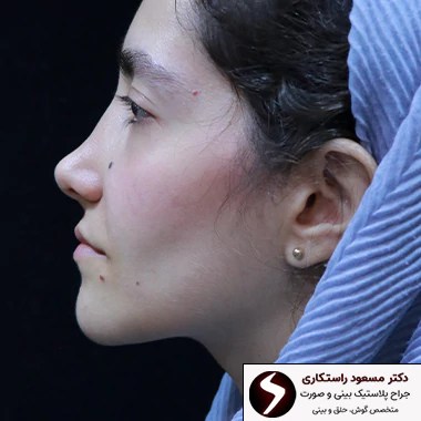 نمونه کار عمل بینی