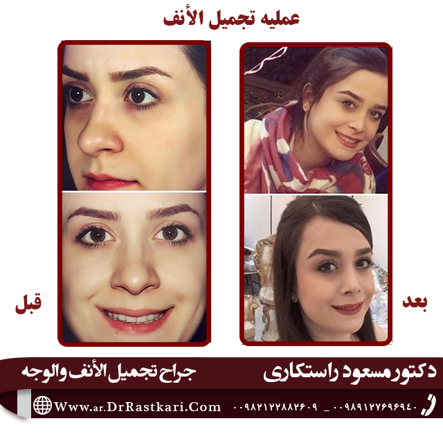 من هو أفضل جراح الأنف في طهران؟