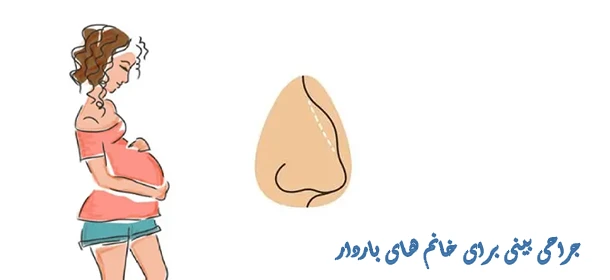 جراحی بینی برای خانم های باردار