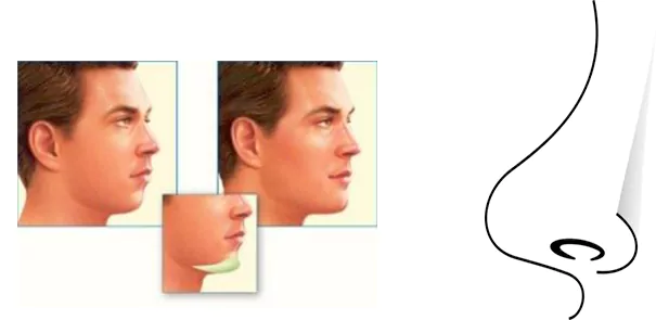 جرحی همزمان بینی و پروتز چانه