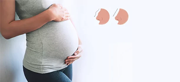 عمل بینی بعد از حاملگی