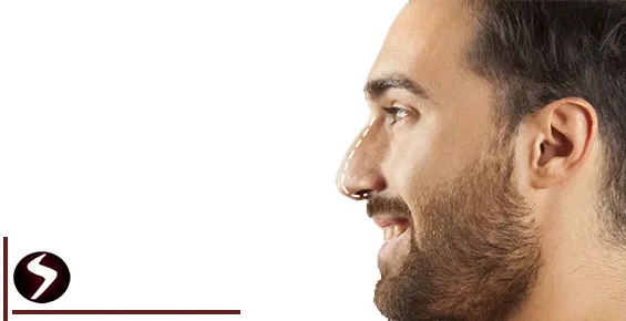 فرم بینی گوشتی برای مردان