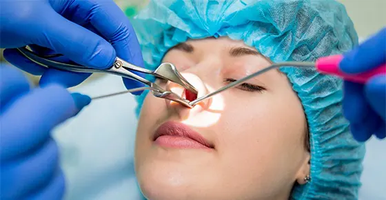 مراقبت‌های بعد از جراحی اندوسکوپی سینوس