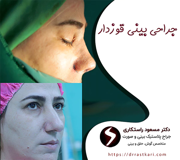 جراحی بینی قوزدار جراحی بینی قوزدار