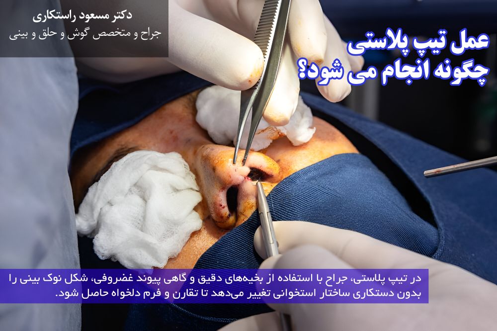 عمل نوک بینی یا تیپ پلاستی چگونه انجام می شود
