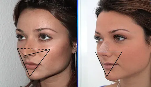 عمل نوک بینی