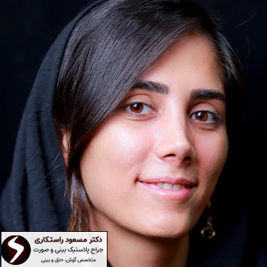 نمونه کار جراحی نوک بینی