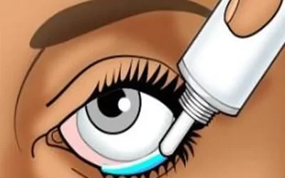 پماد زدن داخل چشم قبل از عمل بینی؛ دلیل و ضرورت