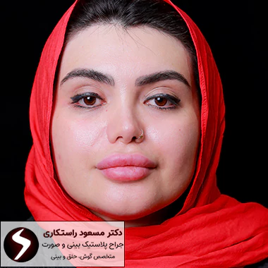 عمل بینی گوشتی چیست؟