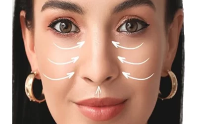 عمل بینی گوشتی؛ فیلم و عکس قبل و بعد عمل + هزینه 1404