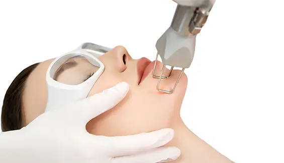 لیزر فرکشنال 